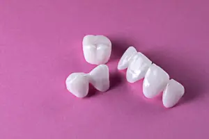 types-of-crowns